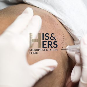 scalp micropigmentation