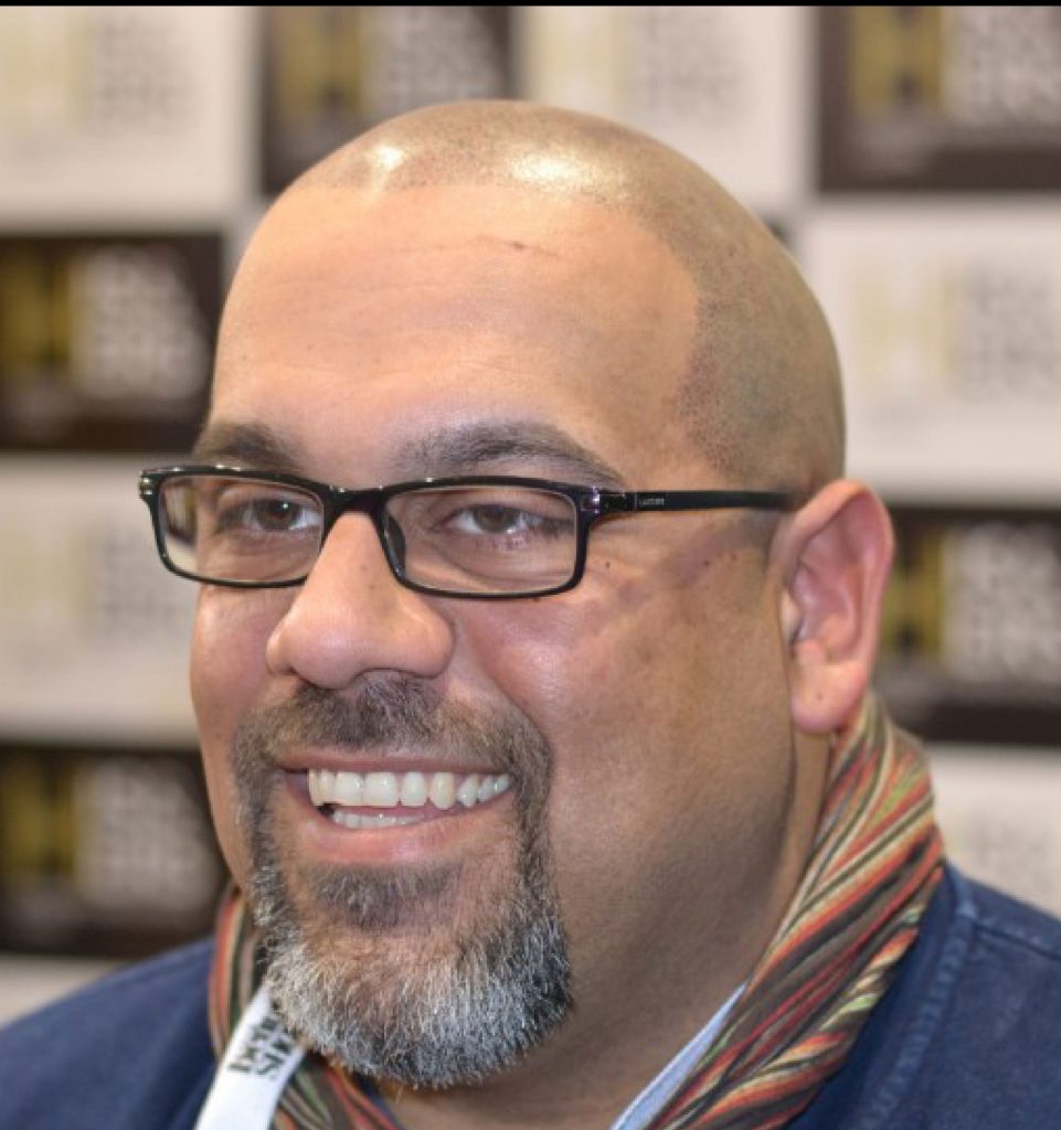 scalp-micropigmentation-smp